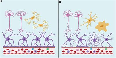 Extracellular Vesicle Proteins and MicroRNAs as Biomarkers for Traumatic Brain Injury